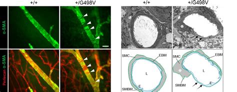 Reducing Timp3 or vitronectin ameliorates disease 